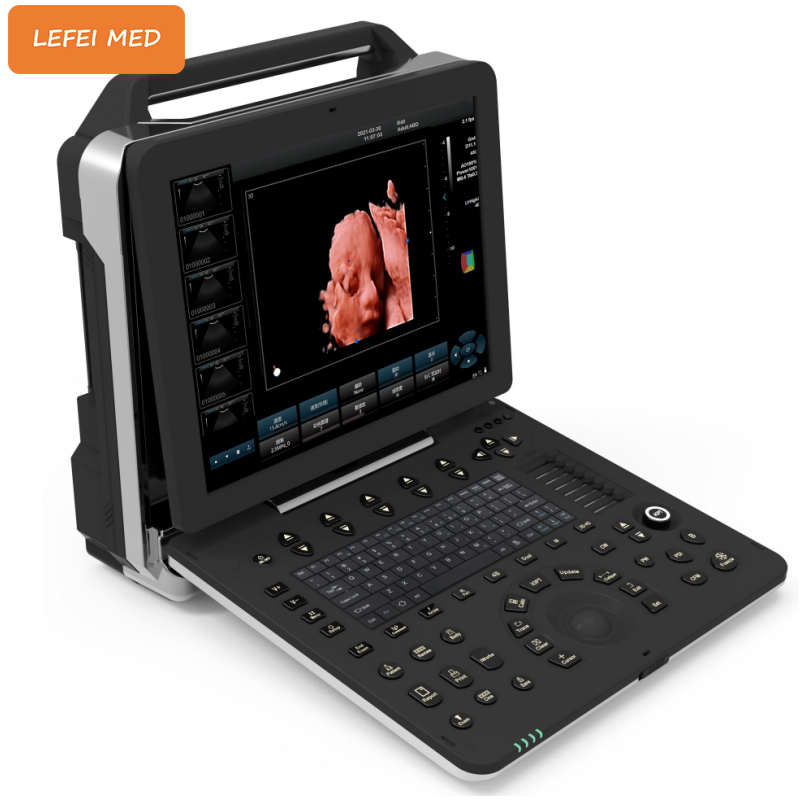 LF0456 Portable 4D Color Doppler