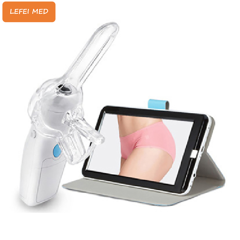 LF5600 Portable Digital Electronic Colposcope