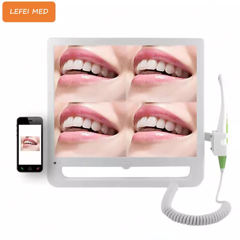 LF9662A Dental Camera Without Touch Function