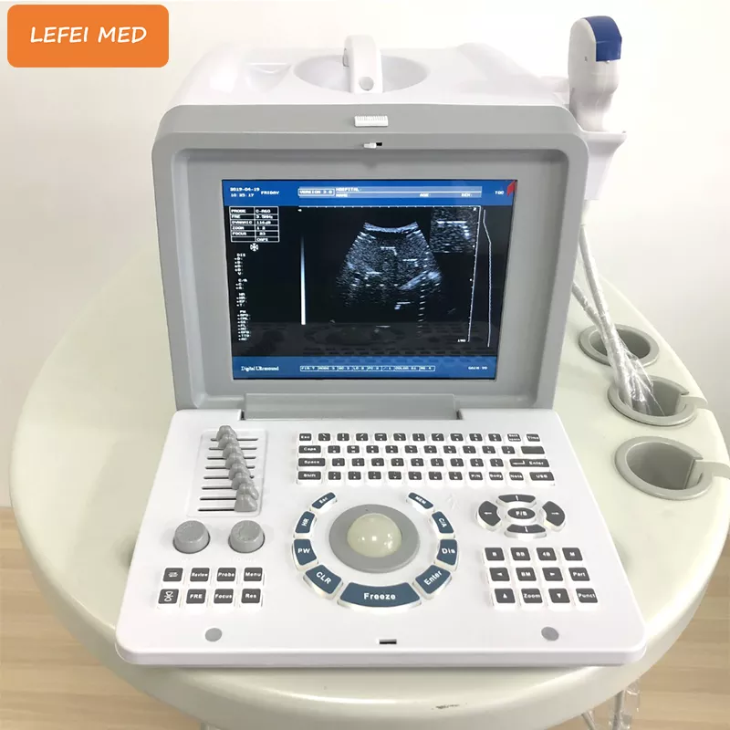 LF0402 Portable Ultrasound Scanner