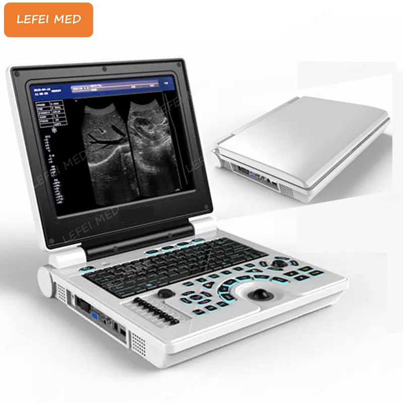 LF0401 12.6 Inches LED Full Digital Laptop Ultrasound