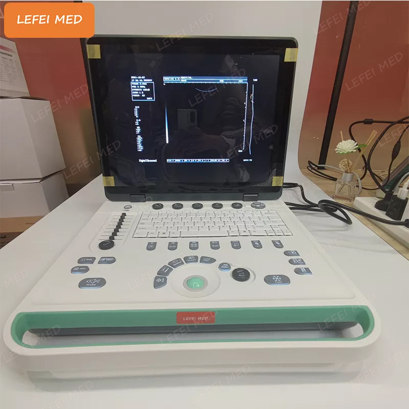 LF0400 Laptop Ultrasound Scanner